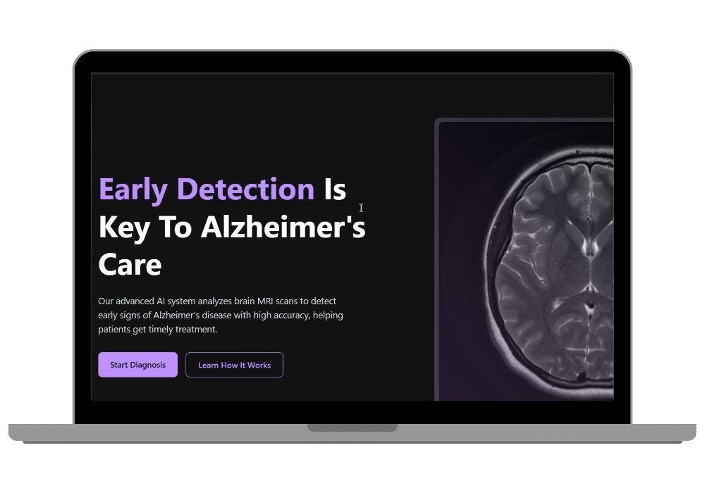 Alzheimer Detection using MRI Brain Scan