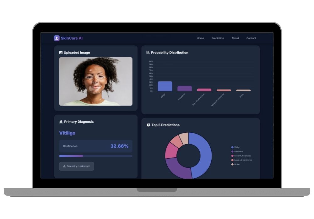 AI-Powered Skin Cancer Detection System - Deep Learning Final Year Project